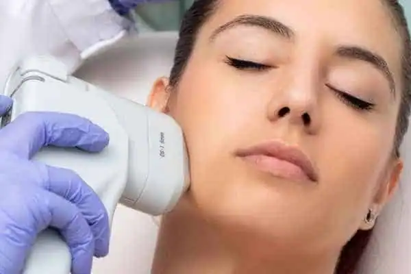 Image of woman having HIFU Nantwich treatment