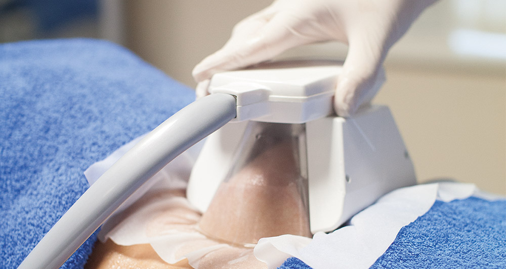 How Fat Freezing and HIFU Work Together? 2 Multiple Areas in One Session HIFU and Fat Freezing Nantwich