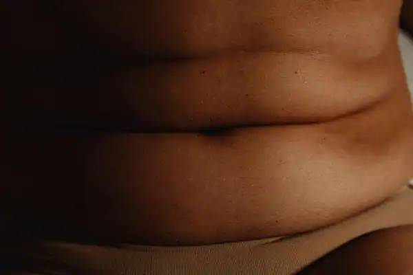The Hidden Connection: How Stress Shapes Your Fitness and Body Composition 3 image of what stress can do on the stomach area and how Lipo 360 Nantwich can help to change your body shape.